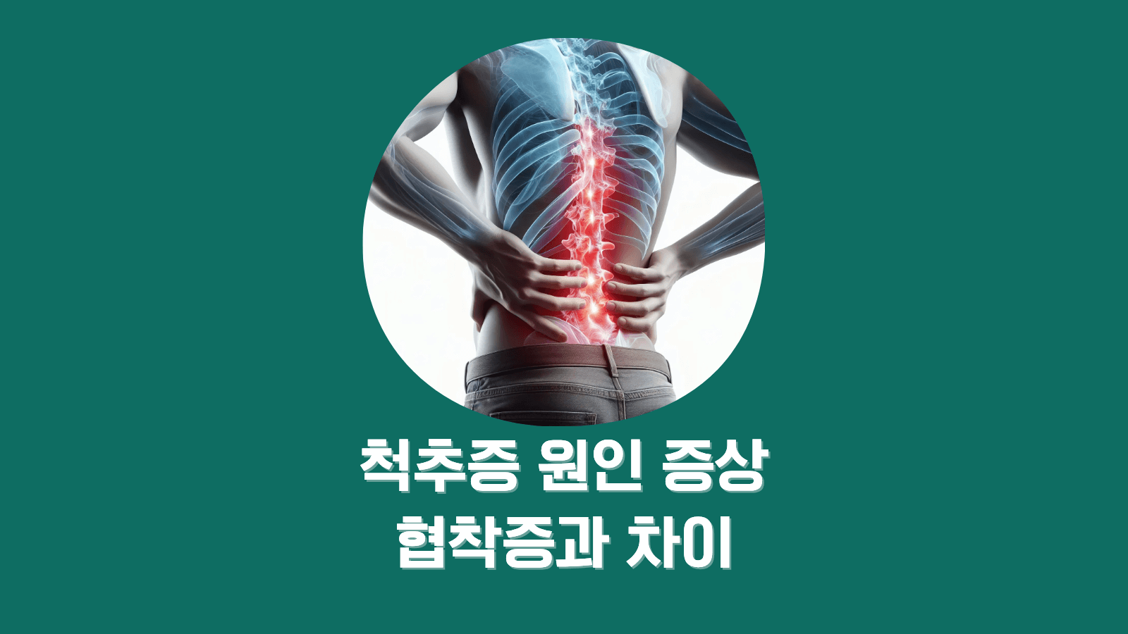 척추 퇴행성 질환 Spondylosis, 증상과 예방법 5가지 한눈에 보