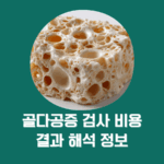 골다공증 검사 비용과 결과 해석, 지금 꼭 알아야 할 5가지 정보