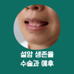 설암 수술 전 반드시 점검할 예후 요인 7가지