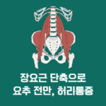 장요근(iliopsoas) 단축이 허리 통증을 유발하는 5가지 이유와 해결법