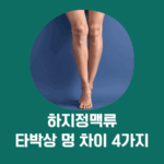 하지정맥류 멍 vs 타박상 멍, 결정적 차이 4가지