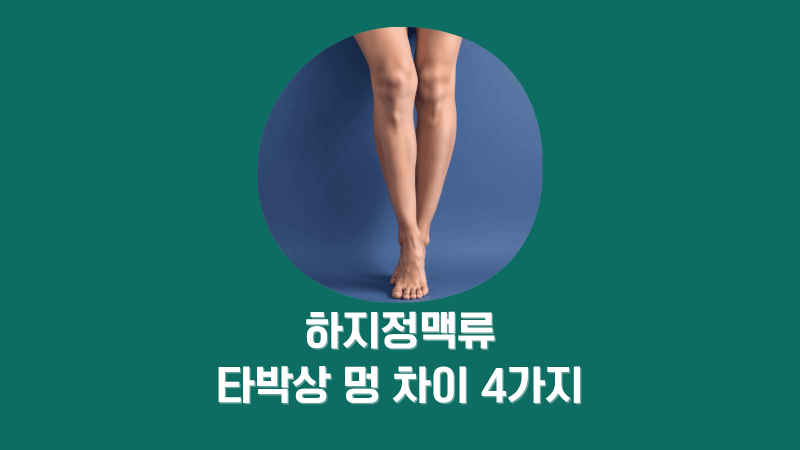 하지정맥류 멍 vs 타박상 멍, 결정적 차이 4가지