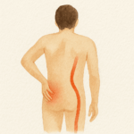 좌골신경통 증상 6가지와 자가진단 물리치료사가 직접 겪어보고 정리함