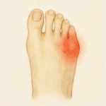 통풍 초기증상 5가지 | 발목 발가락 부었을 때 자가진단 방법까지