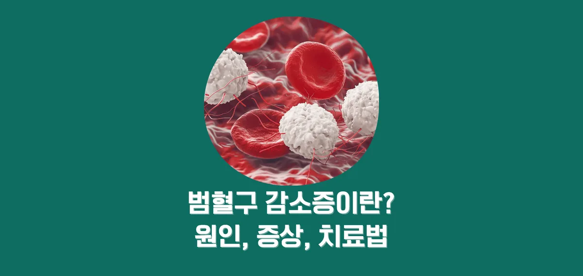 범혈구감소증의 원인과 증상, 치료를 소개하는 기존 편집 이미지